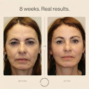 Nicebeam 9-in-1 Laser Light Therapy Lamp for Skin & Hair Rejuvenation